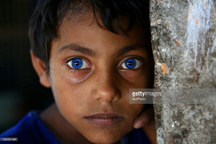 사람들이 하는 오해: 아시아 사람들은 다 눈동자가 짙은갈색? | 인스티즈