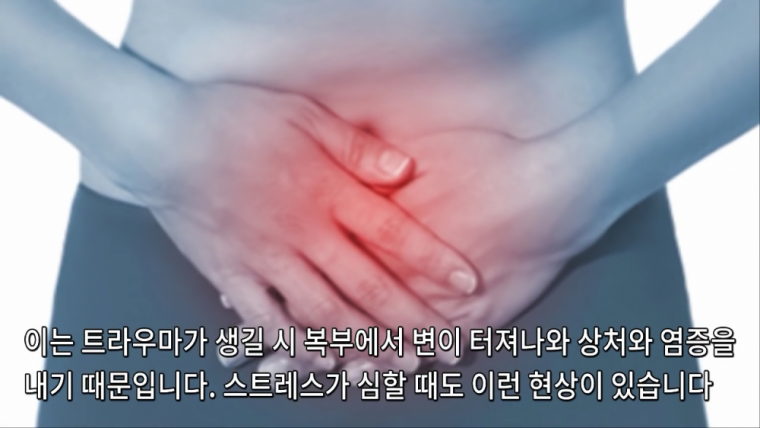 전투에 임할시 신체변화 | 인스티즈