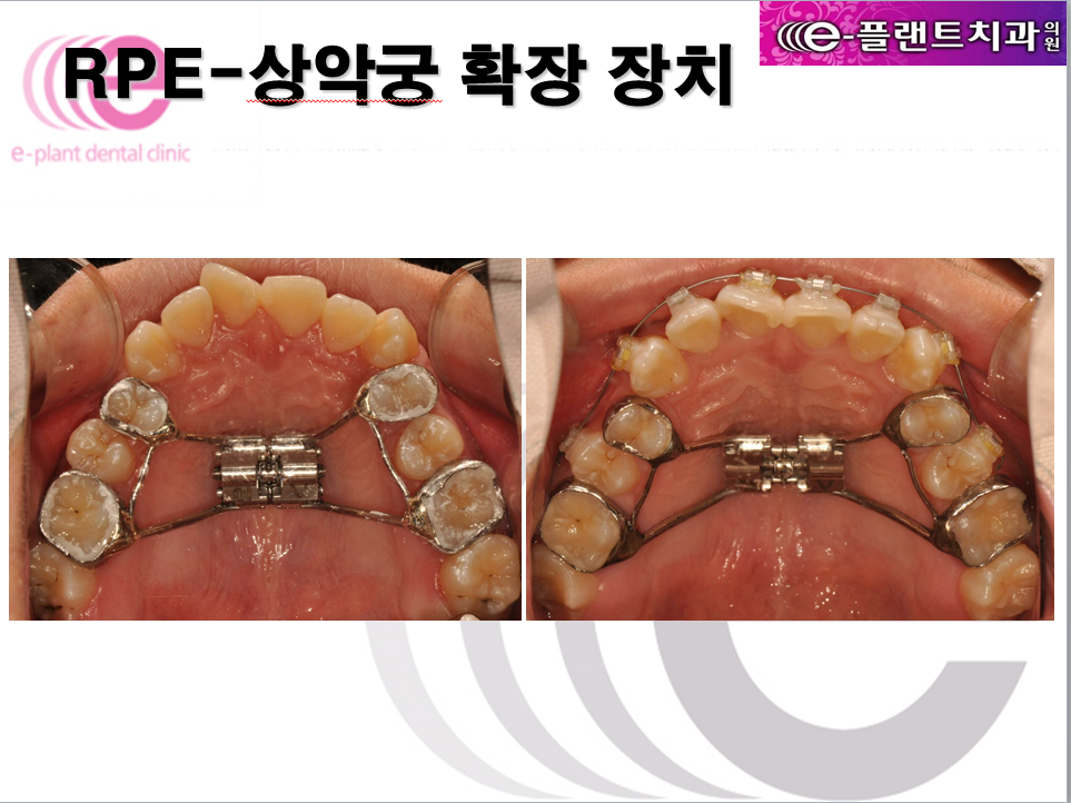 e-플랜트치과 이미지