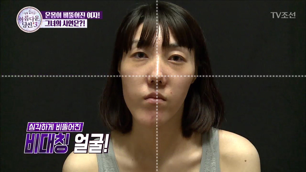[렛미인역대급] 부정교합을 방치하면 안되는 이유 | 인스티즈