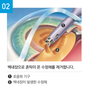 광주안과의원 이미지