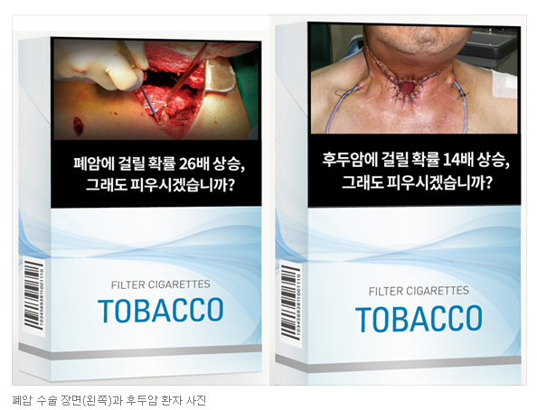 12월 23일부터 시행한 답뱃갑 경고그림 (혐오주의) | 인스티즈