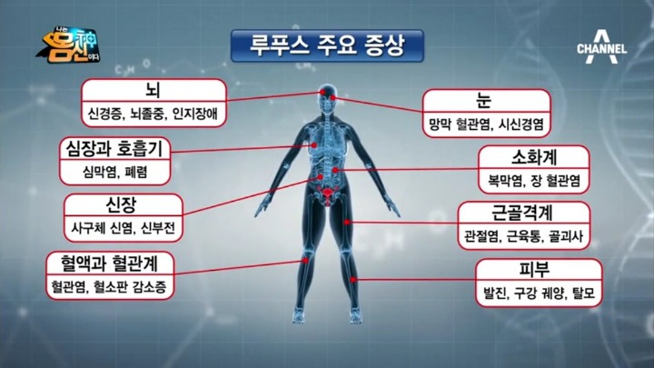 셀레나 고메즈가 친구에게 신장이식 받은 이유.jpg | 인스티즈