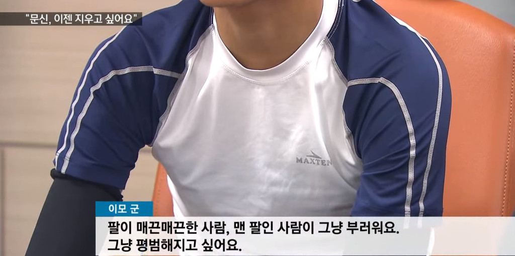문신, 이제 지우고 싶어요! | 인스티즈